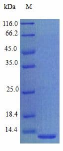 Human PROK1 / EG-VEGF Protein (Recombinant)