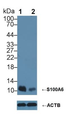Polyclonal Rabbit anti-Human S100A6 / Calcyclin Antibody (aa1-90, IHC, WB)