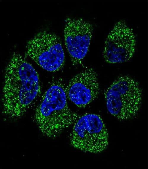 Polyclonal Rabbit anti-Human OPG / Osteoprotegerin Antibody (aa243-271, IHC, IF, WB)