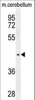 PTOV1 Antibody (aa25-52)