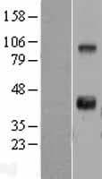 WNT11 Protein (Over-Expression Lysate Myc-DDK (Flag))