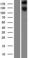 ROBO1 Protein (Over-Expression Lysate Myc-DDK (Flag))