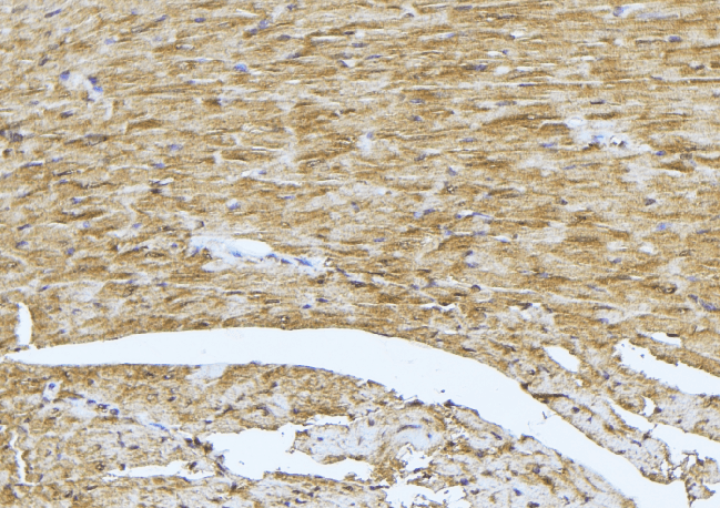 TCAP / Telethonin Antibody