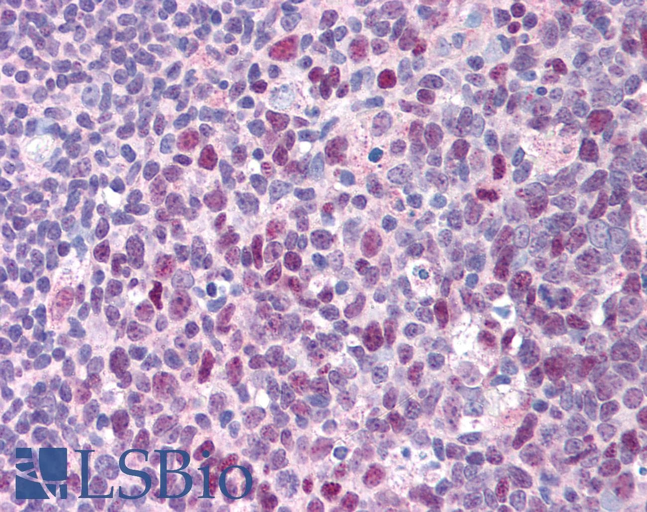 IHC-plus™ ERCC3 / XPB Antibody (C-Terminus, Preservative Free)