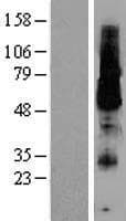 KCNK18 / TRESK Protein (Over-Expression Lysate Myc-DDK (Flag))