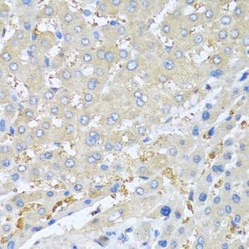 CXCL7 / PPBP Antibody