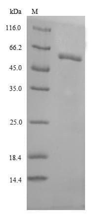 Human GBA / Glucosidase Beta Acid Protein (Recombinant)