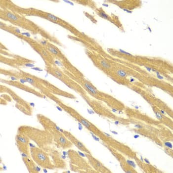 BCL2 / Bcl-2 Antibody