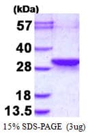 Human LDOC1L Protein (Recombinant His)