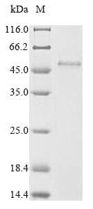 Human PVRIG Protein (Recombinant 6His-SUMO, N-terminus)
