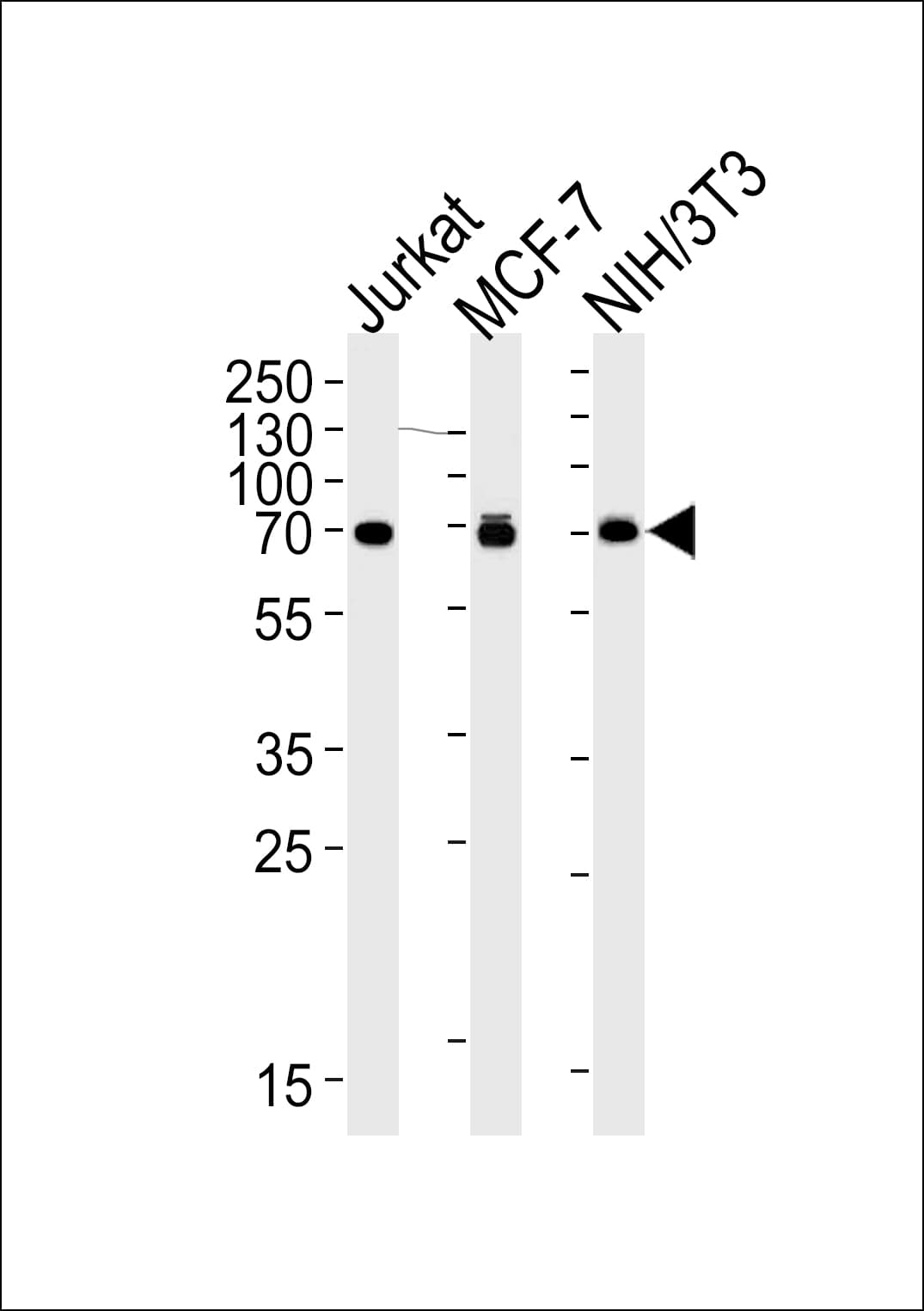 Monoclonal Mouse anti-Human RPS6KB2 / S6K2 Antibody (WB)