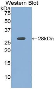 ATP1B3 Antibody (aa61-273)