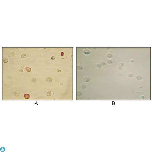 Monoclonal Mouse anti-Human HHV-8 ORF45 Antibody (WB)