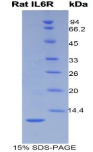 Rat IL6R / IL6 Receptor Protein (Recombinant His)