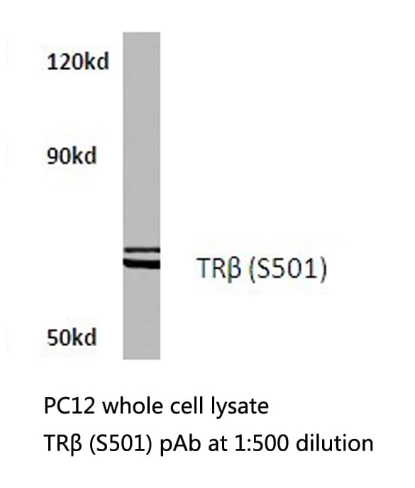 TXNRD2 Antibody (Ser501)
