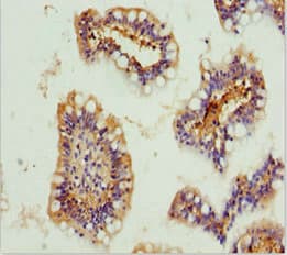 Polyclonal Rabbit anti-Human GNA15 Antibody (IHC, WB)