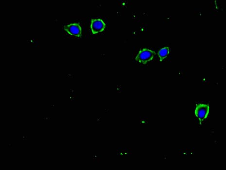 TGFBR2 Antibody