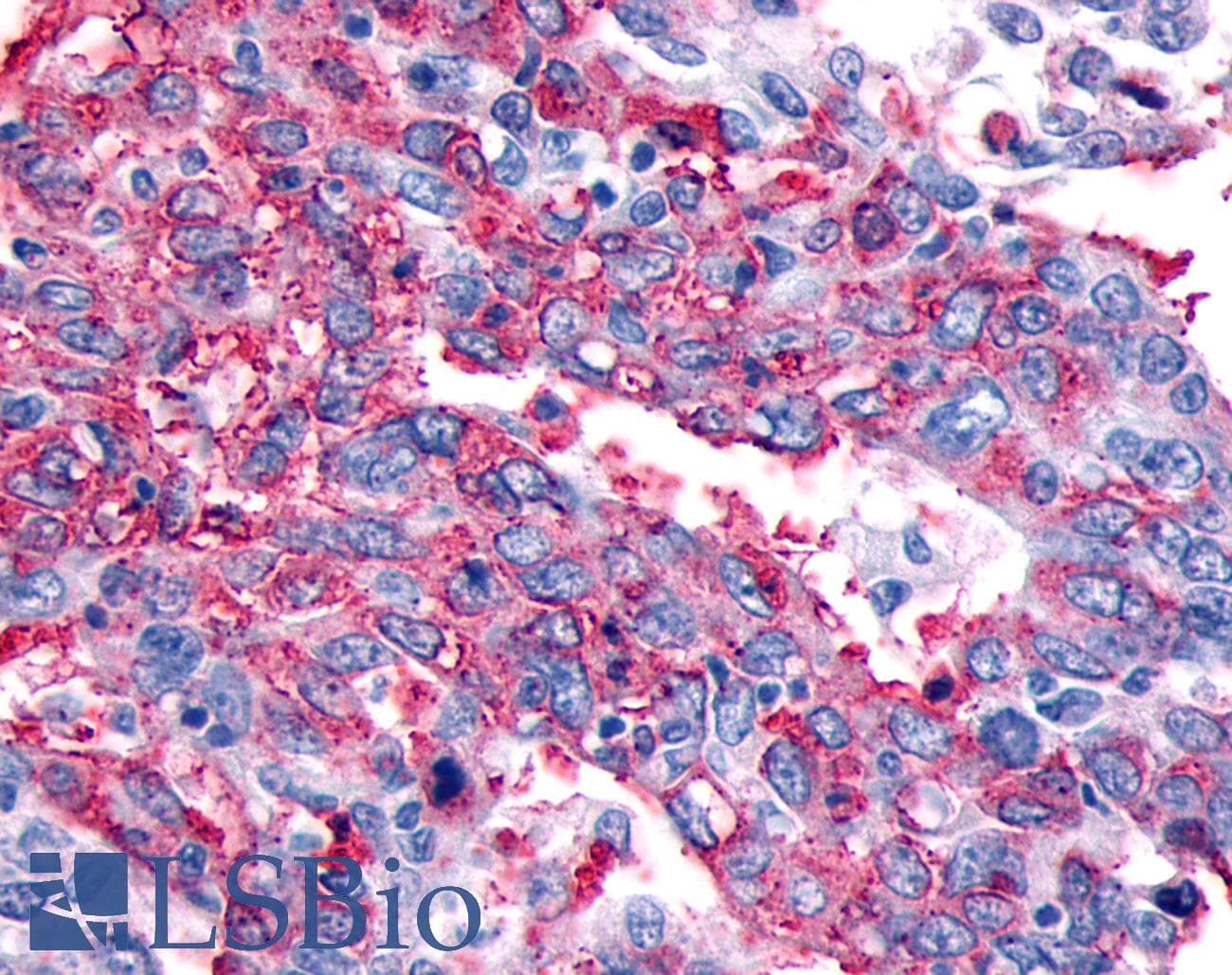 PathPlus™ Polyclonal Rabbit anti-Human CALCRL / CGRP Receptor Antibody (N-Terminus, IHC)