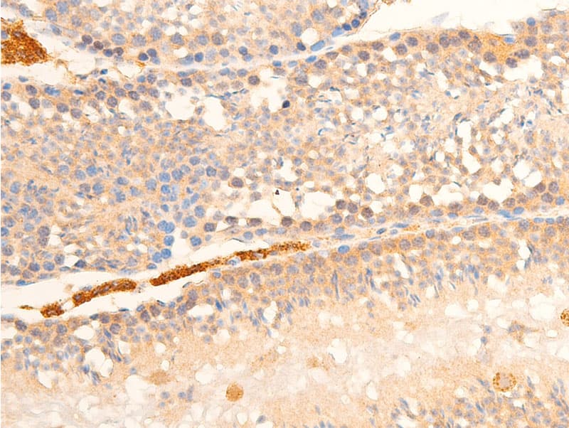 RELA / NFKB p65 Antibody (phospho-Ser536)