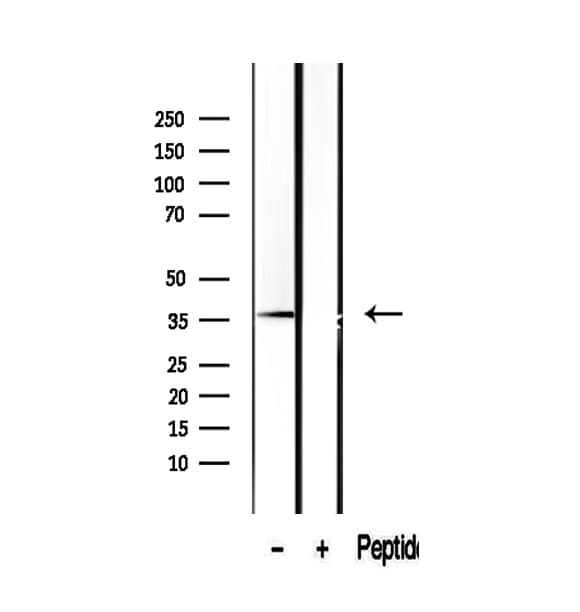 SUGT1 / SGT1 Antibody