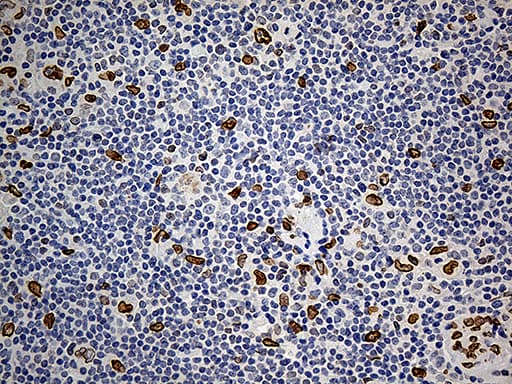 Monoclonal Mouse anti-Human SLU7 / 9G8 Antibody (clone OTI5A7, aa1-300, IHC, WB)