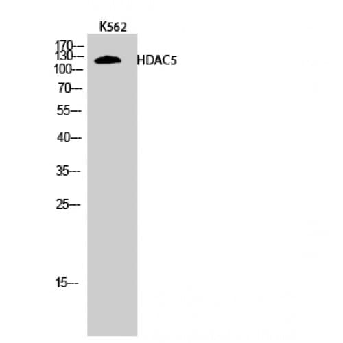 HDAC5 Antibody (440-520 aa)