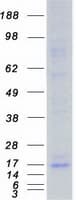 Human TOMM20 Protein (Recombinant Myc-DDK (Flag))