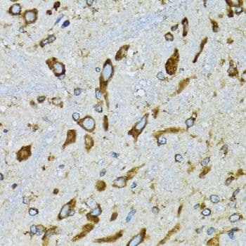 RPN1 / Ribophorin I Antibody