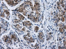 Monoclonal Mouse anti-Human DCXR Antibody (clone OTI7D11, IHC, WB)