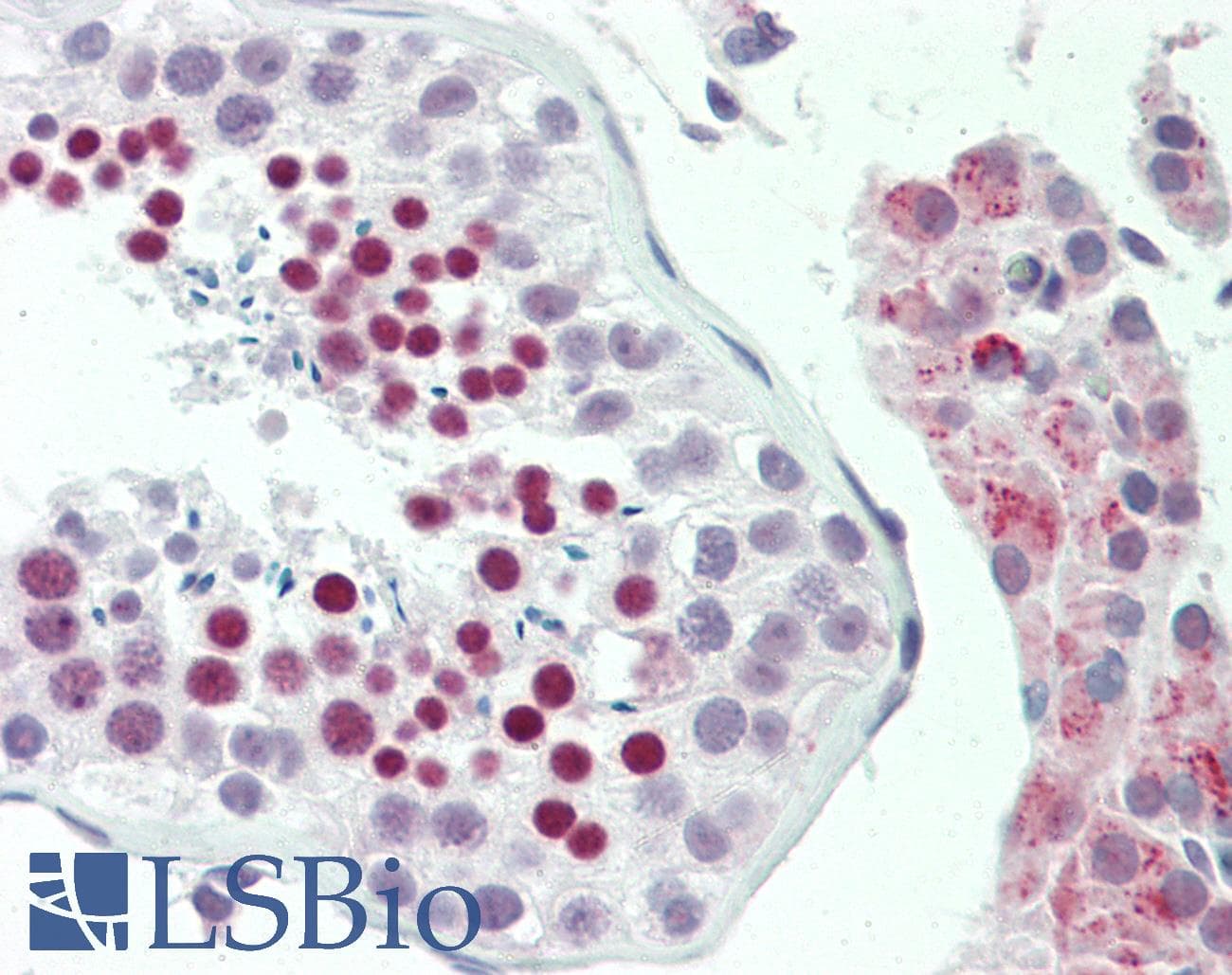 IHC-plus™ Polyclonal Rabbit anti-Human ZFP91 Antibody (aa216-245, IHC, WB)