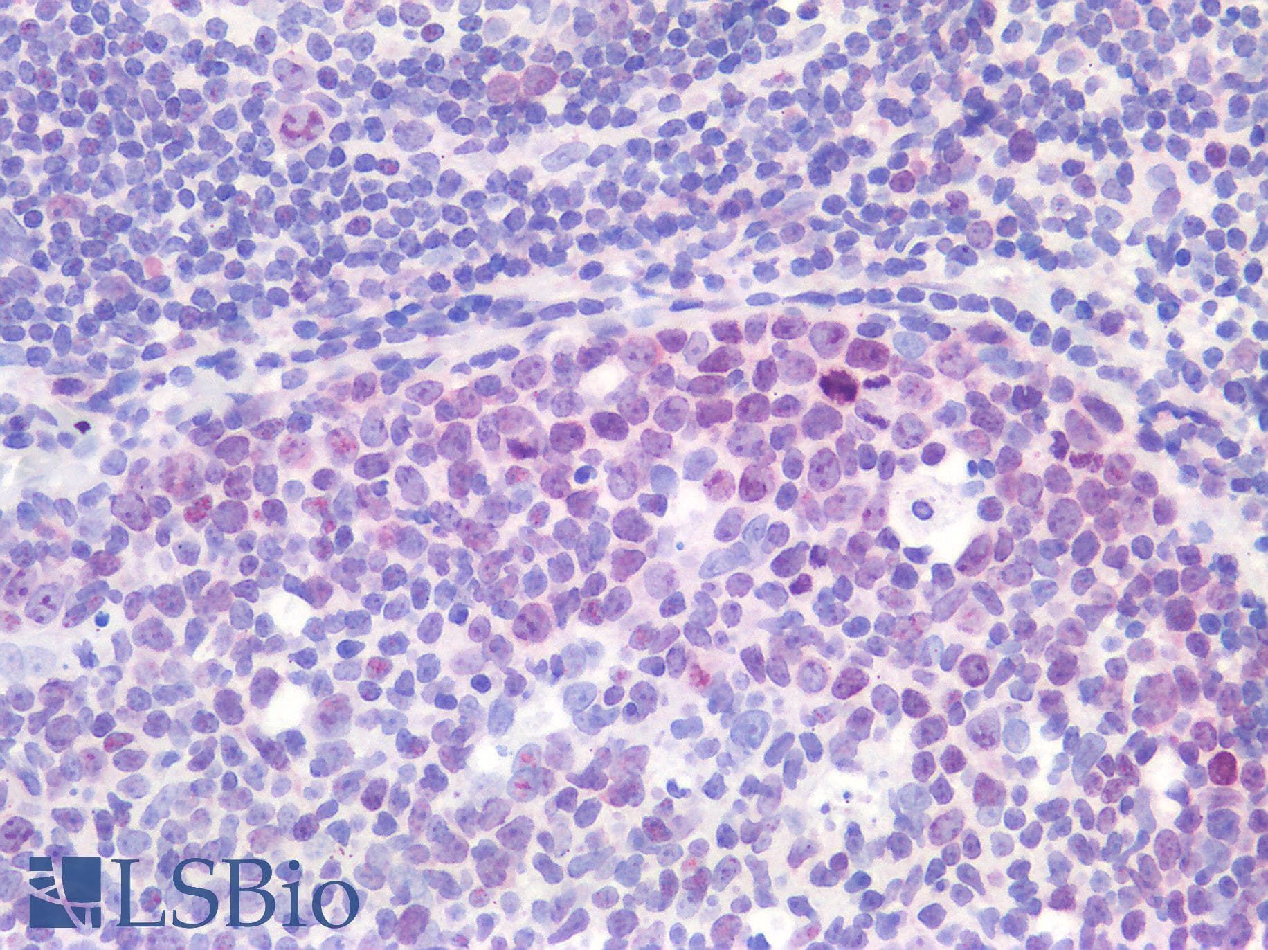 IHC-plus™ Polyclonal Rabbit anti-Human MKI67 / Ki67 Antibody (IHC)