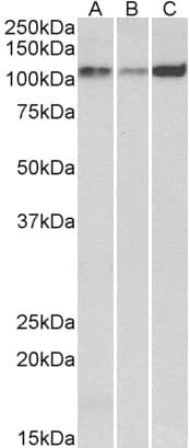 IHC-plus™ ATP2A2 / SERCA2 Antibody (aa658-671)