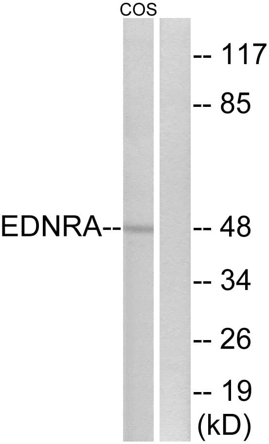 IHC-plus™ EDNRA / Endothelin A Receptor Antibody (aa378-427)