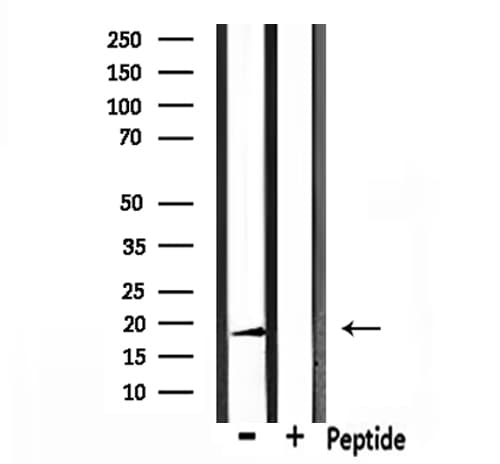 Polyclonal Rabbit anti-Human RARRES3 Antibody (WB)