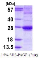 Human ARL15 Protein (Recombinant His)