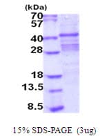 Human ACP2 / Acid Phosphatase 2 Protein (Recombinant His)