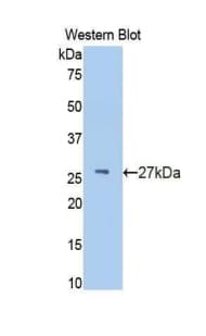 IFNAR1 / IFNAR Antibody (aa28-227, APC)
