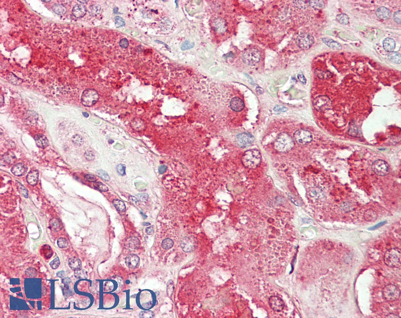 ORM2 / Orosomucoid 2 Antibody (Biotin)