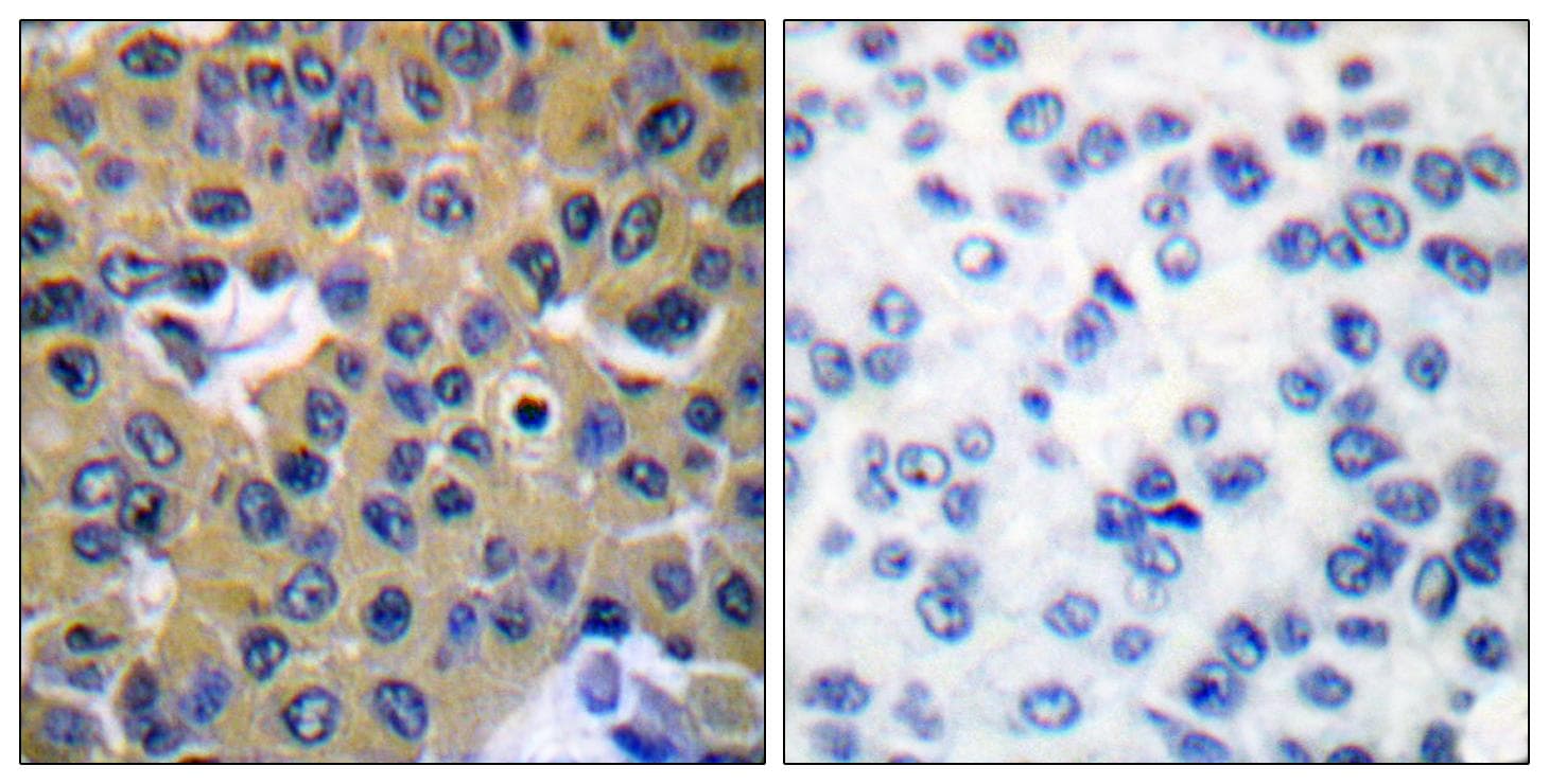 PTPN11 / SHP-2 / NS1 Antibody (phospho-Tyr542)