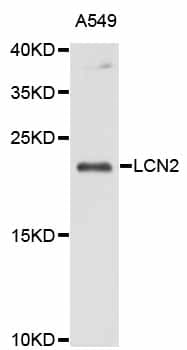 LCN2 / Lipocalin 2 / NGAL Antibody