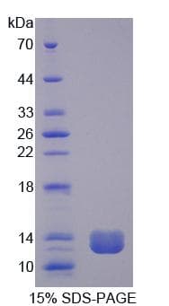 Rat TFF1 / pS2 Protein (Recombinant His-T7)