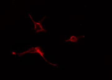 ADCY5 / Adenylate Cyclase 5 Antibody