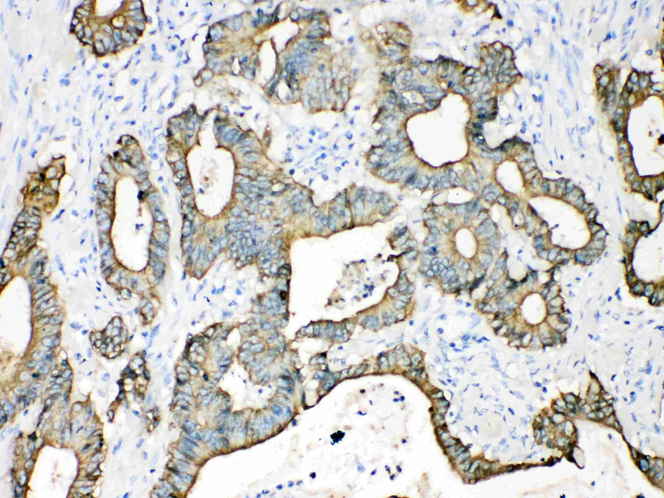 KRT18 / CK18 / Cytokeratin 18 Antibody