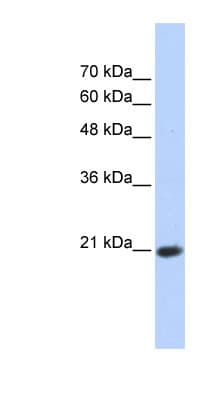 TCEAL8 Antibody (aa35-84)