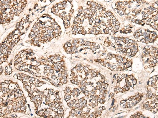 Polyclonal Rabbit anti-Human Complement C1s Antibody (IHC)