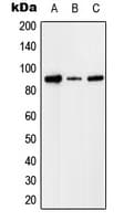 CFI / Complement Factor I Antibody (Internal)