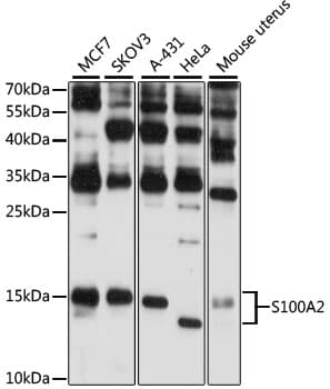 S100A2 Antibody