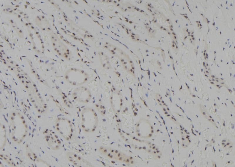 SUV39H1 Antibody