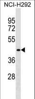 DPF1 / Neuro-D4 Antibody (aa220-247)