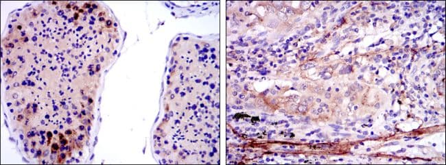 SMN1 Antibody (clone 2F1)